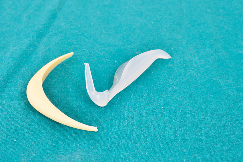 Hastaya Özgü İmplant