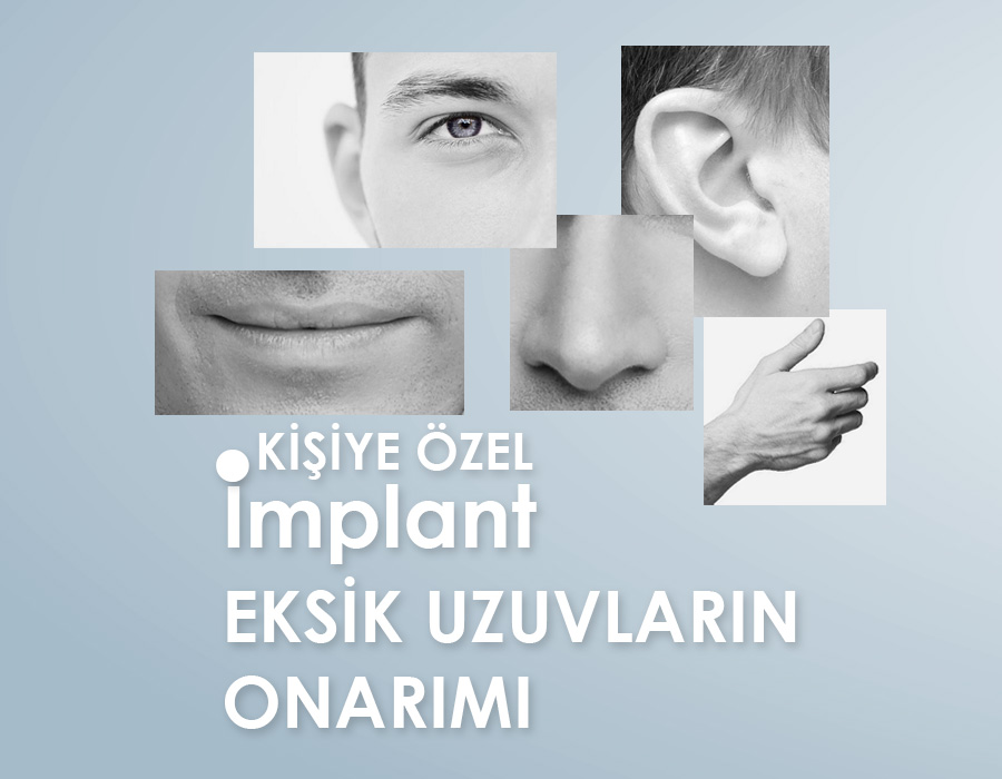 Epitez - Kişiye Özel İmplant